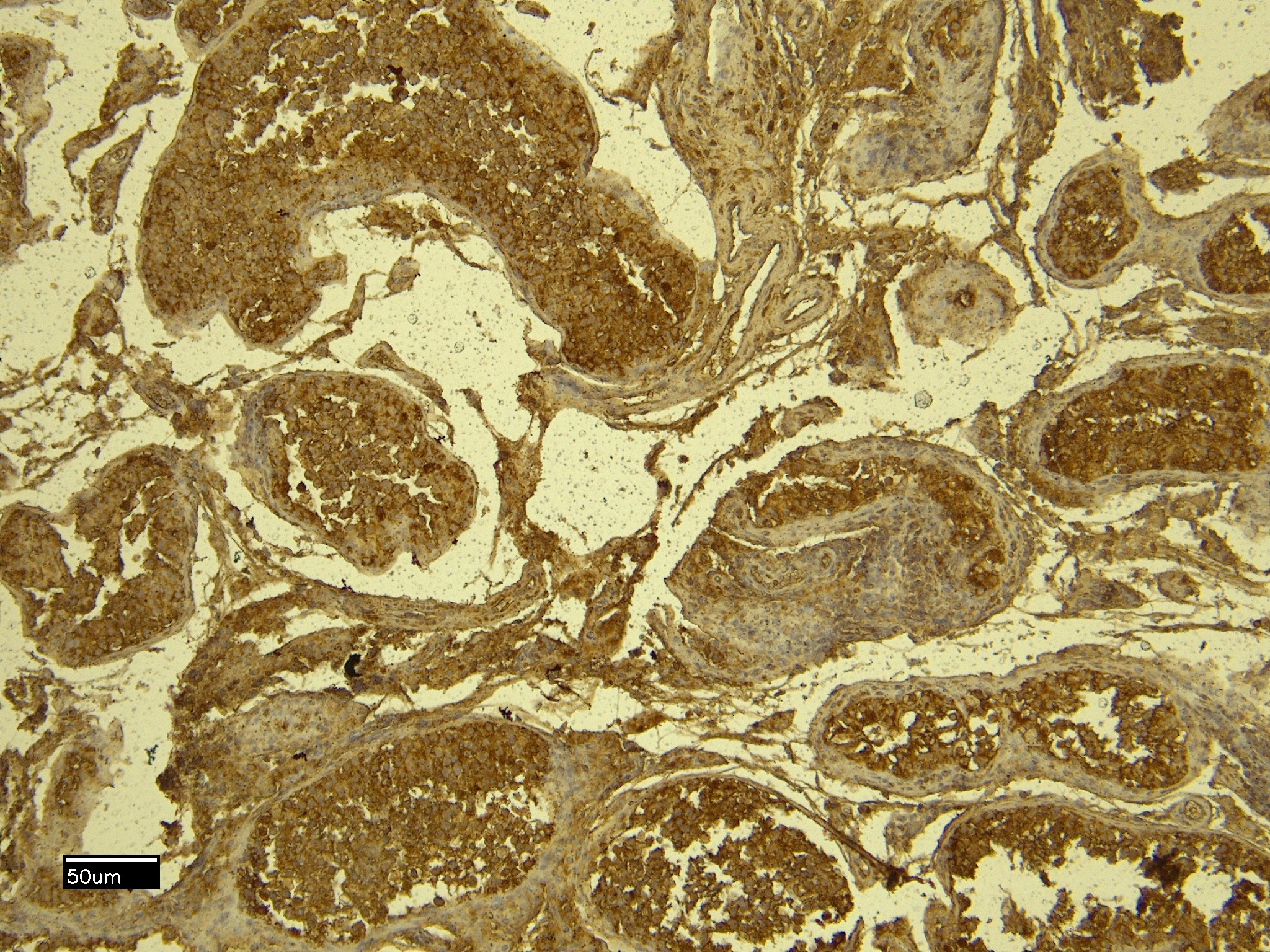 IHC - Goat Anti-STK39 / SPAK Antibody AF2042a